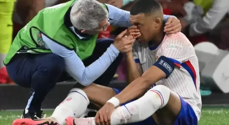 Mbappé, delantero del Real Madrid sufre fractura de nariz Mbappé, delantero del Real Madrid sufre fractura de nariz